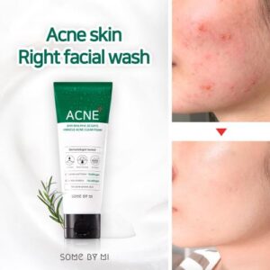 [SOMEBYMI] AHA.BHA.PHA 30 Days Miracle Foam 100ml